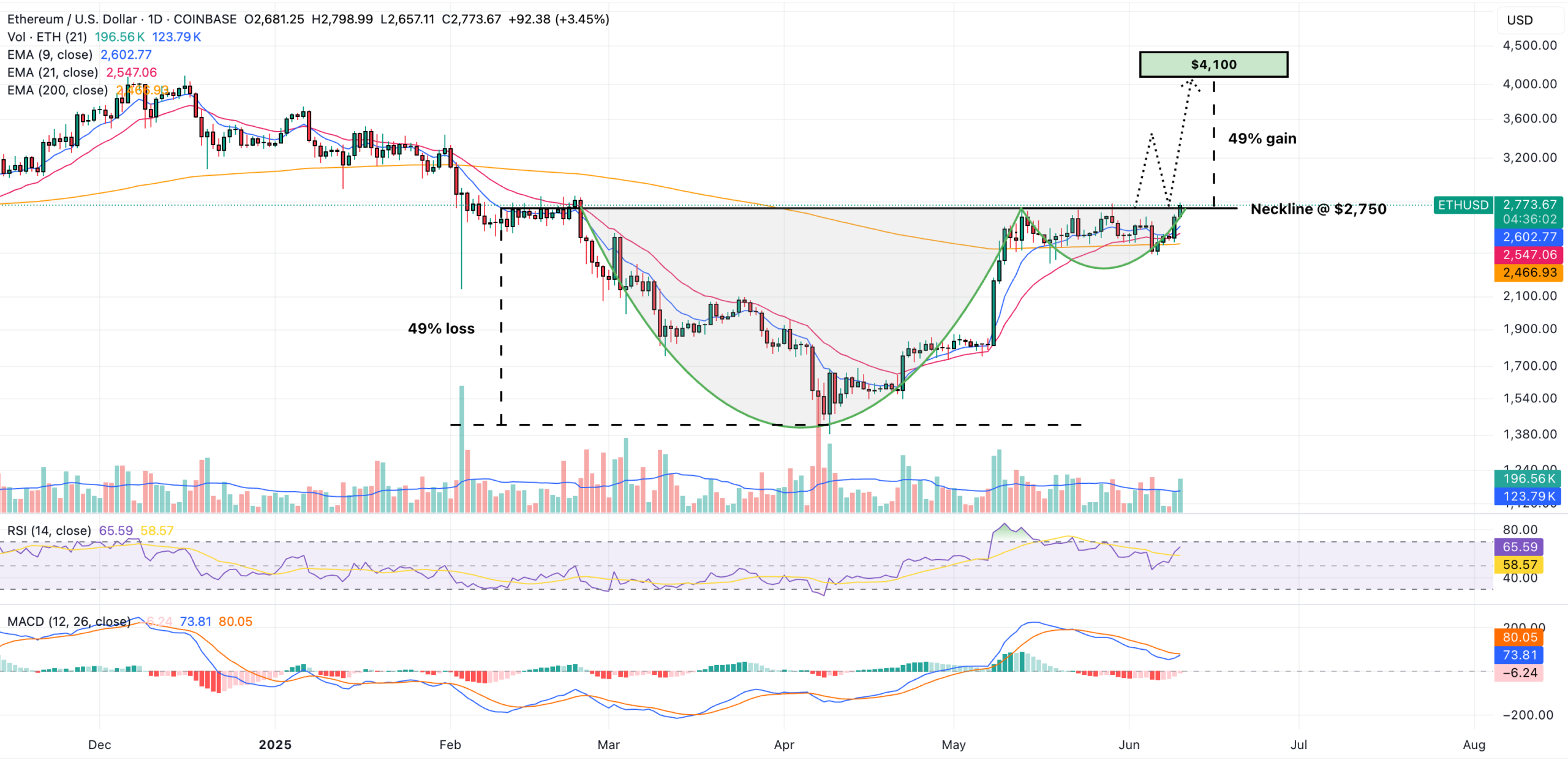 ethereum price prediction